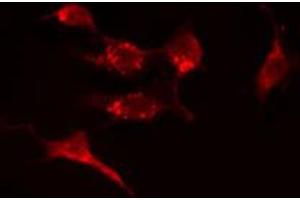 ABIN6274389 staining A549 cells by IF/ICC. (CERKL Antikörper  (Internal Region))