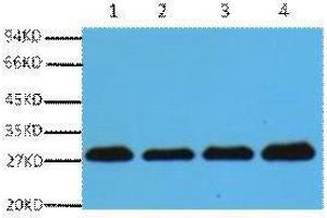 Western Blotting (WB) image for anti-Proliferating Cell Nuclear Antigen (PCNA) antibody (ABIN3181103) (PCNA Antikörper)