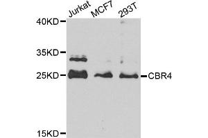 Western blot analysis of extracts of various cell lines, using CBR4 antibody (ABIN5972931) at 1/1000 dilution. (CBR4 Antikörper)