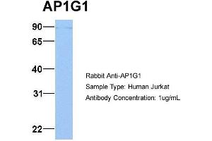 Host: Rabbit Target Name: AP1G1 Sample Type: Jurkat Antibody Dilution: 1. (gamma 1 Adaptin Antikörper  (C-Term))