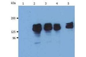 Western Blotting (WB) image for anti-Inositol Polyphosphate-5-Phosphatase, 145kDa (INPP5D) (N-Term) antibody (ABIN238500) (INPP5D Antikörper  (N-Term))