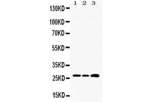 Western blot analysis of RPL19 expression in rat liver extract ( Lane 1) HEPA whole cell lysates ( Lane 2) and HEPG2 whole cell lysates ( Lane 3). (RPL19 Antikörper  (C-Term))