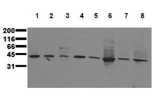 Western Blotting (WB) image for anti-Mitogen-Activated Protein Kinase Kinase 3 (MAP2K3) antibody (ABIN126840) (MAP2K3 Antikörper)