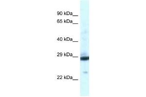 Western Blot showing PGAM1 antibody used at a concentration of 1 ug/ml against Fetal Liver Lysate (PGAM1 Antikörper  (C-Term))