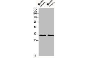 Western blot analysis of MOUSE-HEART MOUSE-BRAIN using Acetyl-TAL1/2 (K221/K222/K36/K37) antibody. (TAL1 Antikörper  (acLys36, acLys37, acLys221, acLys222))
