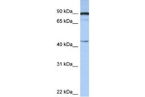 WB Suggested Anti-PSMD6 Antibody Titration:  0. (PSMD6 Antikörper  (N-Term))