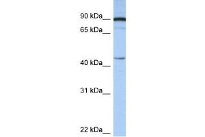Western Blotting (WB) image for anti-Proteasome (Prosome, Macropain) 26S Subunit, Non-ATPase, 6 (PSMD6) (N-Term) antibody (ABIN2779618)