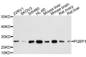 Western blot analysis of extracts of various cell lines, using PQBP1 antibody. (PQBP1 Antikörper  (AA 1-265))