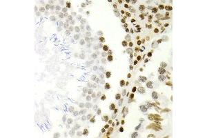 Immunohistochemistry of paraffin-embedded rat testis using NFKB2 antibody at dilution of 1:200 (400x lens). (NFKB2 Antikörper)