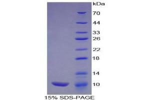 SDS-PAGE (SDS) image for Pro-Platelet Basic Protein (Chemokine (C-X-C Motif) Ligand 7) (PPBP) (AA 46-107) protein (His tag) (ABIN2124134)