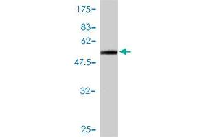 Western Blot detection against Immunogen (46. (TNNI1 Antikörper  (AA 1-187))