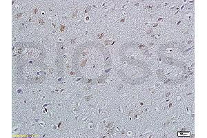 Formalin-fixed and paraffin embedded rat brain labeled with Anti P45017A1/Cytochrome P450 17A1 Polyclonal Antibody, Unconjugated (ABIN720445) at 1:200 followed by conjugation to the secondary antibody and DAB staining (GANAB Antikörper  (AA 428-540))