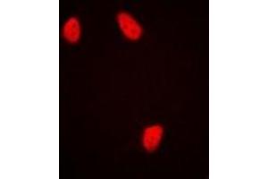 Immunofluorescent analysis of NUDC staining in HepG2 cells.