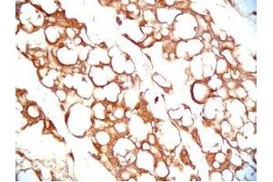 Mouse visceral white fat tissue was stained by Rabbit Anti-Vaspin (386-414) (Human) Serum (SERPINA12 Antikörper  (AA 386-414))