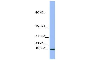 WB Suggested Anti-SEMG1  Antibody Titration: 0.