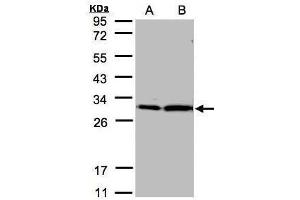 14-3-3 zeta Antikörper  (Center)