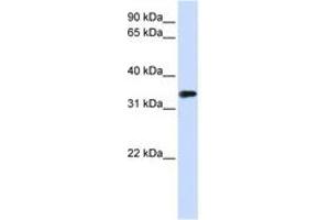 Image no. 1 for anti-Methyl-CpG Binding Domain Protein 3 (MBD3) (AA 72-121) antibody (ABIN6740655) (MBD3 Antikörper  (AA 72-121))