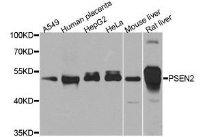 Western blot analysis of extracts of various cell lines, using PSEN2 antibody (ABIN5995411) at 1/1000 dilution. (Presenilin 2 Antikörper)