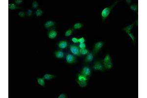 Immunofluorescence staining of Hela cells with ABIN7145079 at 1:166, counter-stained with DAPI. (Aurora Kinase B Antikörper  (AA 1-255))