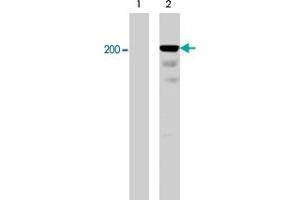 Western blot analysis of A-431 cells serum starved overnight (lane 1) and treated with pervanadate (1mM) for 30 min (lane 2). (Integrin beta 4 Antikörper  (pTyr1526))
