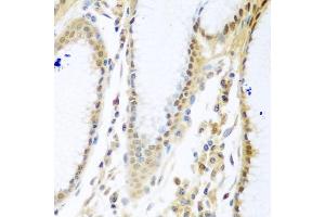 Immunohistochemistry of paraffin-embedded human stomach using MYBBP1A antibody (ABIN5972490) at dilution of 1/100 (40x lens). (MYBBP1A Antikörper)