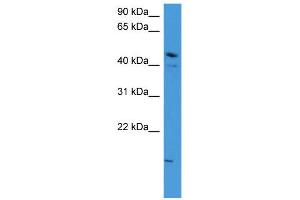 WB Suggested Anti-ZNF713 Antibody Titration: 0. (ZNF713 Antikörper  (N-Term))
