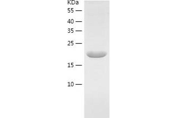 RCL Protein (AA 1-174) (His tag)