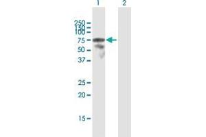 Western Blot analysis of LCP2 expression in transfected 293T cell line by LCP2 MaxPab polyclonal antibody. (LCP2 Antikörper  (AA 1-533))