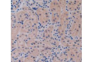 Used in DAB staining on fromalin fixed paraffin- embedded kidney tissue (IL17RE Antikörper  (AA 457-626))