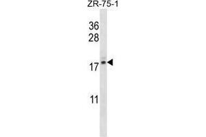 TNP2 Antibody (C-term) western blot analysis in ZR-75-1 cell line lysates (35 µg/lane).