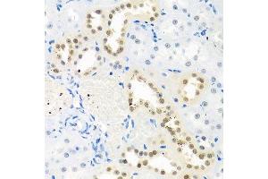 Immunohistochemistry of paraffin-embedded rat kidney using THOC1 antibody. (THOC1 Antikörper  (AA 428-657))