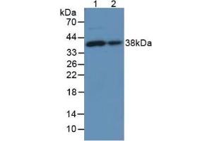 Figure. (LUM Antikörper  (AA 19-338))