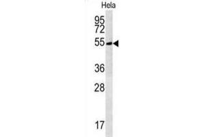 Western Blotting (WB) image for anti-tRNA Methyltransferase 11 Homolog (Trmt11) antibody (ABIN3002328) (Trmt11 Antikörper)