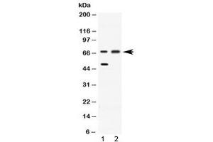 Western blot testing of 1) rat liver and 2) HeLa lysate with ACADVL antibody at 0. (ACADVL Antikörper  (AA 538-576))