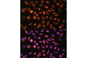 Immunofluorescence analysis of L929 cells using SH3PXD2A Rabbit pAb (ABIN6135104, ABIN6147731 and ABIN7101844) at dilution of 1:100. (SH3PXD2A Antikörper)