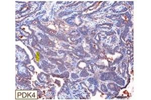 Multiplex Immunohistochemistry (mIHC) image for anti-Pyruvate Dehydrogenase Kinase, Isozyme 4 (PDK4) (AA 382-410) antibody (ABIN3028963)