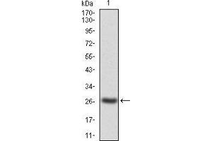 Western blot analysis using JAK2 mAb against human JAK2(AA: 745-955) recombinant protein. (JAK2 Antikörper  (AA 745-955))