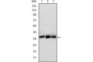 Western blot analysis using MSI2 mouse mAb against NTERA-2 (1), SW620 (2) and T47D (3) cell lysate. (MSI2 Antikörper)