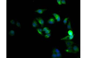 Immunofluorescence staining of Hela Cells with ABIN7127439 at 1:50, counter-stained with DAPI. (Rekombinanter CXCR4 Antikörper)