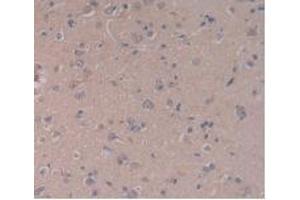 IHC-P analysis of Human Brain Tissue, with DAB staining. (TLR5 Antikörper  (AA 693-858))