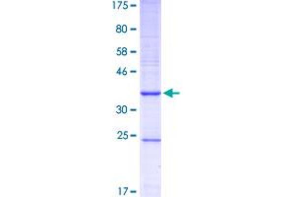 CYP1B1 Protein (AA 453-542) (GST tag)