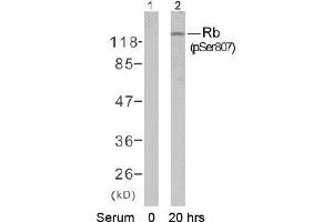 Image no. 1 for anti-Retinoblastoma 1 (RB1) (pSer807) antibody (ABIN196840) (Retinoblastoma 1 Antikörper  (pSer807))