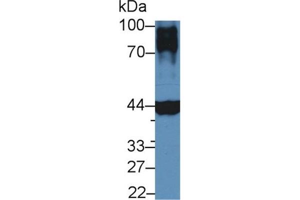 Cardiac Troponin T2 Antikörper  (AA 56-271)