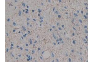 Immunohistochemistry (IHC) image for anti-Insulin-Like Growth Factor 1 (IGF1) (AA 49-118) antibody (ABIN7442501)