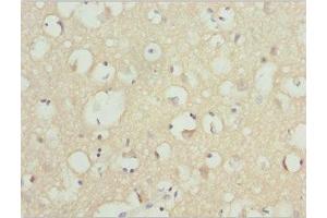 Immunohistochemistry of paraffin-embedded human brain tissue using ABIN7161608 at dilution of 1:100 (NINL Antikörper  (AA 1-190))