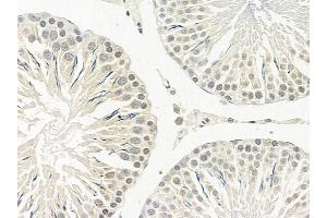 anti-Zinc Finger Protein 600 (ZNF600) (Internal Region) antibody