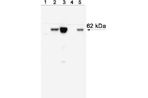 Western blot analysis of T-bet expressed by Mouse Th1 and Th2 cells and Human NK cell and T cell leukemia lines and Peripheral Blood Mononuclear Cells (PBMC).