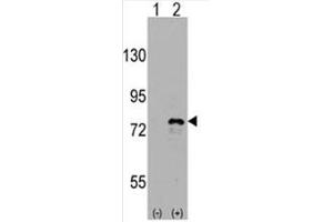 Image no. 2 for anti-DEAD (Asp-Glu-Ala-Asp) Box Polypeptide 3, X-Linked (DDX3X) (C-Term) antibody (ABIN357007) (DDX3X Antikörper  (C-Term))
