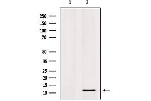 Western blot analysis of extracts from HepG2, using RPL36 Antibody.