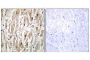 Immunohistochemistry (IHC) image for anti-LIM Domain Kinase 2 (LIMK2) (Internal Region) antibody (ABIN1849456) (LIMK2 Antikörper  (Internal Region))